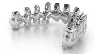 puente dental 1