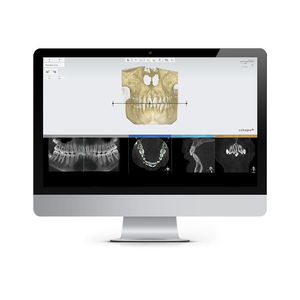 software de planificación de tratamiento