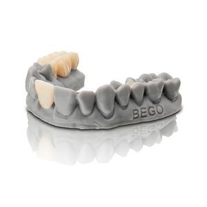 material dental de cerámica 1