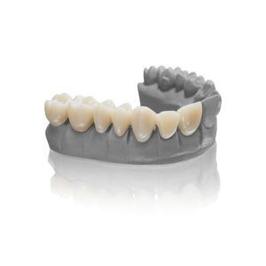 material dental de resina 1