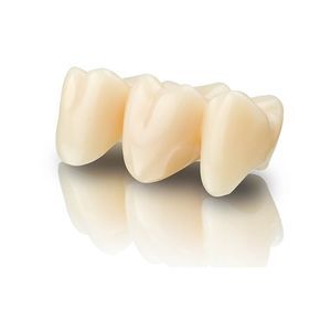 material dental de cerámica 1