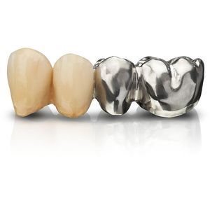 material dental de cromo cobalto 1
