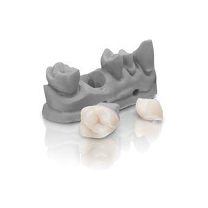 material dental para impresión en 3D