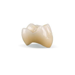 material dental de cerámica de vidrio