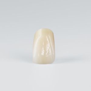 prótesis dental de PMMA