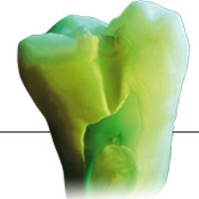 material dental de cerámica