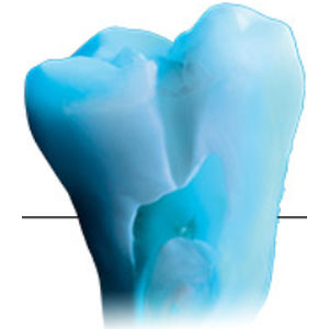 material dental de cerámica