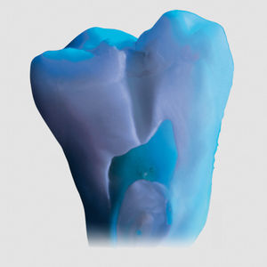 material dental de cerámica