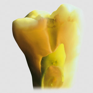 material dental de cerámica