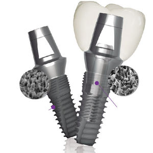 implante dental cónico