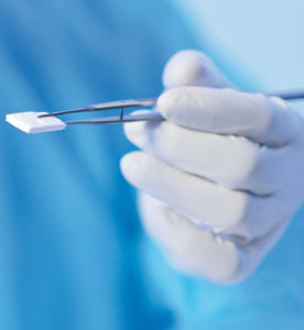 matriz tisular cirugía dental 1