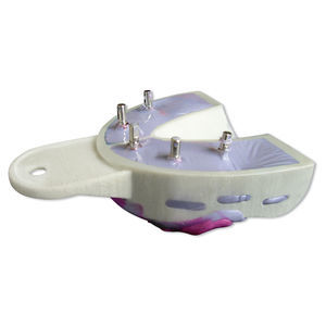molde dental para implantología dental