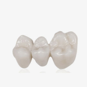 material de restauración dental