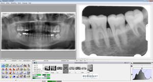 software para imagen dental