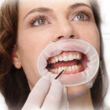 retractor mejillas / labial / para odontología