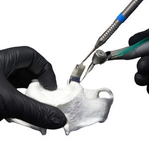 retractor gingival