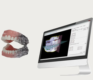 software de laboratorio dental