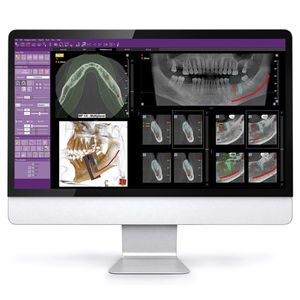 software para imagen dental