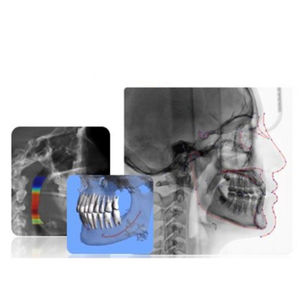 software para imagen dental