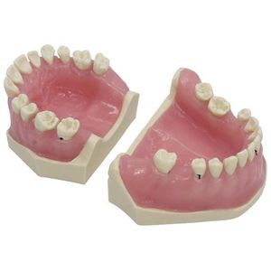 modelo anatómico de dentadura / de formación / de patología / para periodoncia