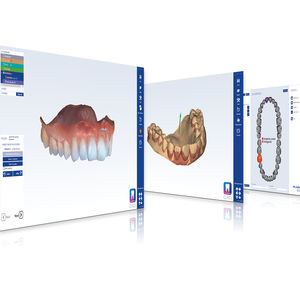 software de creación de prótesis dentales