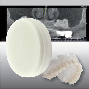 material dental de PMMA / CAD CAM / para imagen dental / de fresado