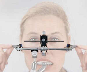 arco facial dental con horquilla oclusal