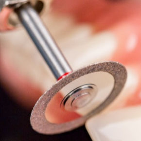 fresa de laboratorio dental