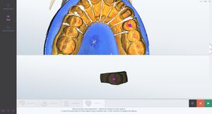 software de laboratorio dental