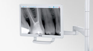 monitor para odontología