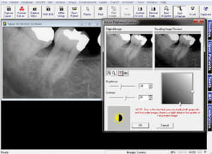 software para imagen dental