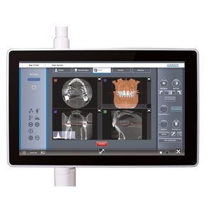 monitor para odontología