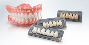 prótesis dental de los dientes anteriores 1