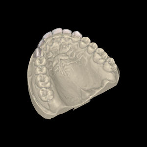 módulo de software de laboratorio dental