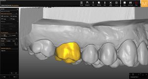 módulo de software de laboratorio dental