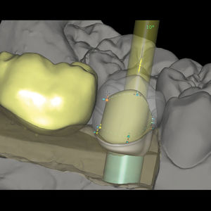 módulo de software de laboratorio dental