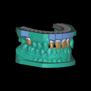 módulo de software de laboratorio dental