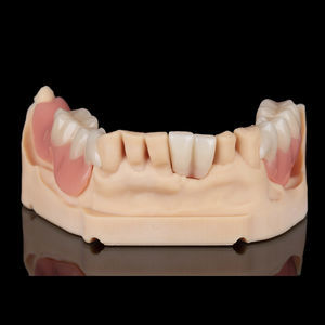 prótesis dental de resina 1