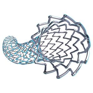 stent arteria coronaria 1