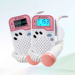 Doppler fetal 1