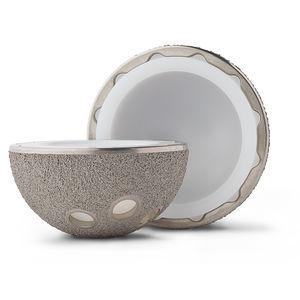 prótesis acetabular no cementada 1