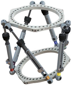 fijador externo para tibia