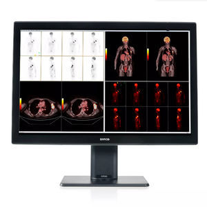 monitor médico