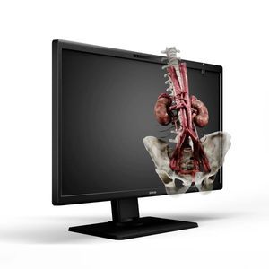 monitor médico