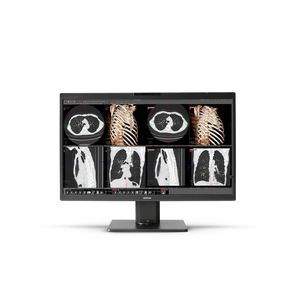 monitor médico