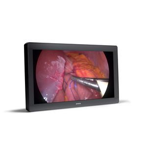 monitor médico 1