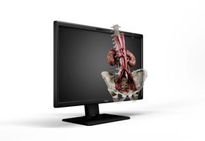 monitor para sala de operaciones