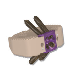 caja intersomática lumbar 1