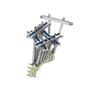 sistema de posicionamiento de tornillos pediculares