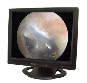 monitor para endoscopia